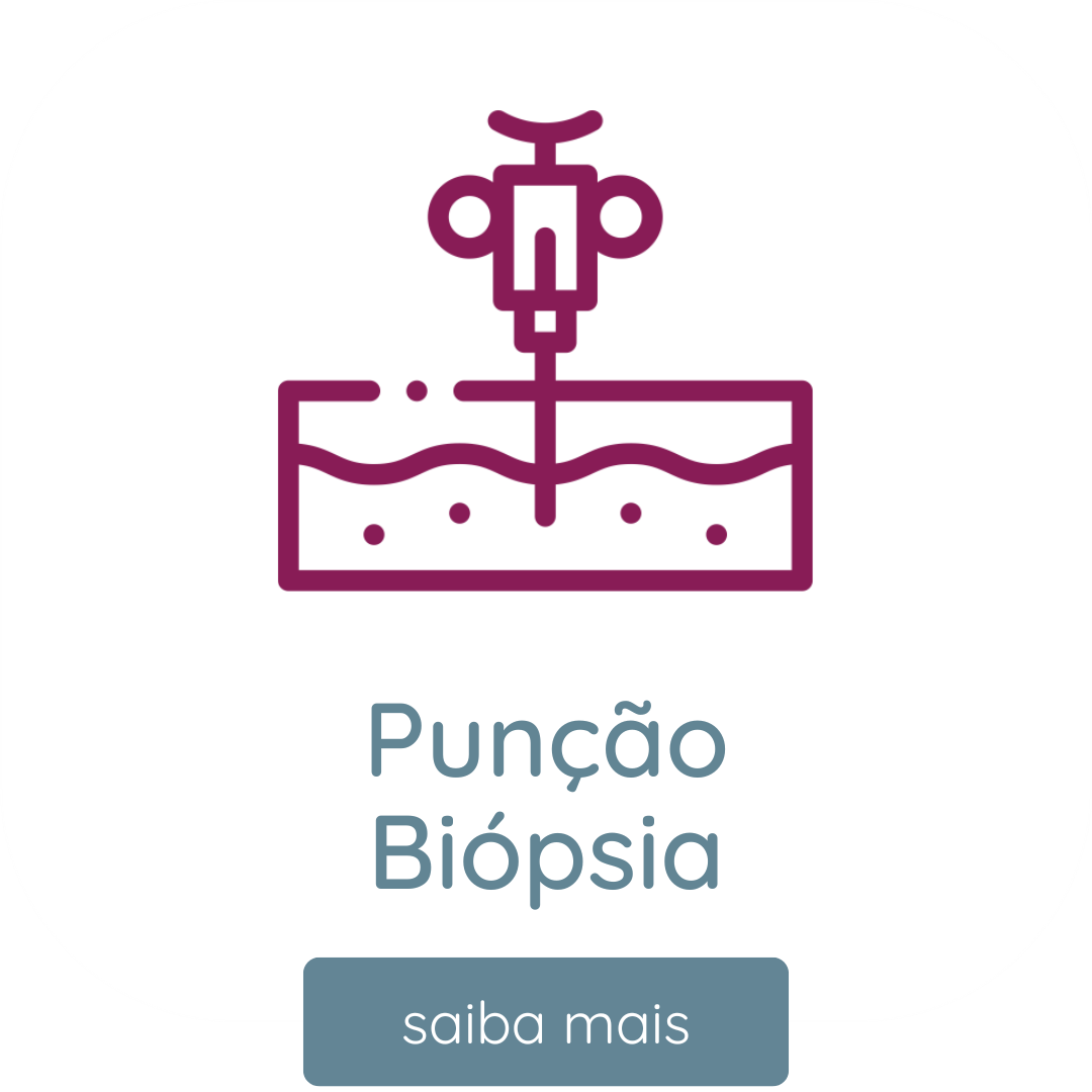 Exame de Biopsia